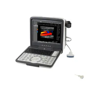Top Quality Color Ultrasonic Diagnostic System Digital Ultrasound Machine with Wholesale Price