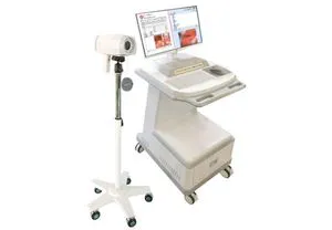 Medical Diagnostic Equipment Portable Colposcope Women Gynecological Examination Machine Camera Video Colposcope Equipment