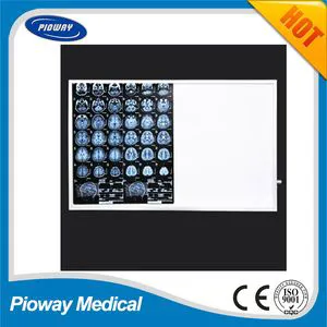 Super Thin X-ray Film Viewer YYG