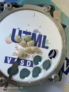 High - Performance Dental Material: Vasden 3D - Utml Multilayer Zirconia Blocks for Exceptional Restorations