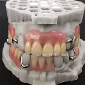 Dental Lab China Custom Removable Partial Dentures Metal Framework Acrylic Teeth Perfect Fit Fast Delivery