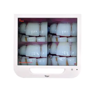 Medical Equipment 17 Inch Monitor Intra Oral Camera Coms 1/4 HD for Dental Chair Unit