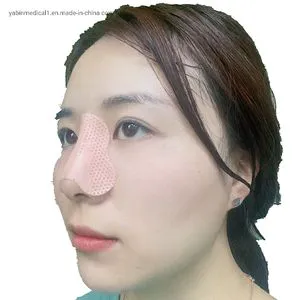 Nose Cast Thermoplastic Nasal Splint for Nose Surgery Fracture Rhinoplasty Rehabilitation Brace Protection Splinting Sheet CE ISO13485