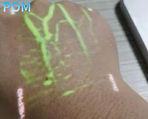 Clear-View Infrared Vein Finder for Varicose Veins Management Medical Product