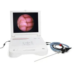 Medical Monitor Diagnostic Ent Machine Arthroscope Endoscopy Camera HD Portable Endoscopy Unit
