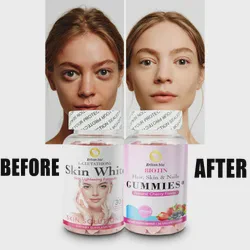 Anti-Aging Healthy Whitening Skin L-Glutathione Gummies 5000mcg Biotin Detox Improve Immunity Gummy