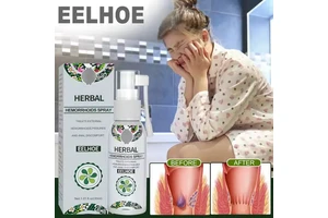EELHOE Anal Internal Hemorrhoids Piles External Anal Fissure Natural Herbal Hemorrhoids Spray Hemorrhoid