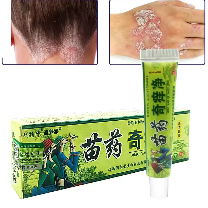 100% Original Powerful Cure Psoriasis Ointment Urticaria Desquamation Dermatitis Eczema Cream Ingredient Security Skin Care