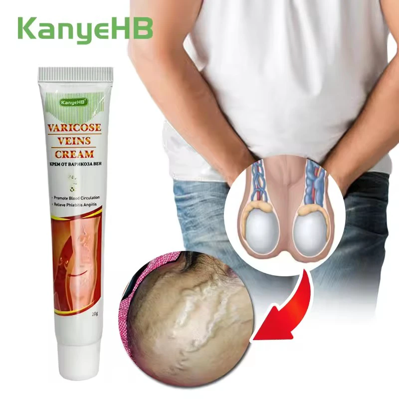 Varicocele Ointment Genitals Varicocele Ceam Scrotum Blood Vessel Swelling Pain Relief Cream Varicose Veins Cream