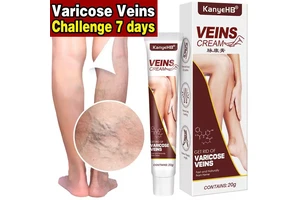 Varicose Veins Treatment Cream Leg Vein Skin Herbal Care Ointment Anti-swelling Varicocele Varices Medical Plaster Leg Care Tool
